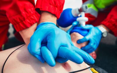 Measuring Cerebral Perfusion During CPR